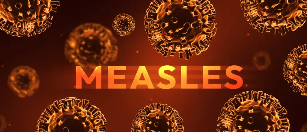 Concept artwork of viruses with the word "Measles."